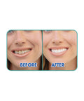 immagine-4-best-direct-spazzolino-da-denti-ad-ultrasuoni-ean-0644812053917